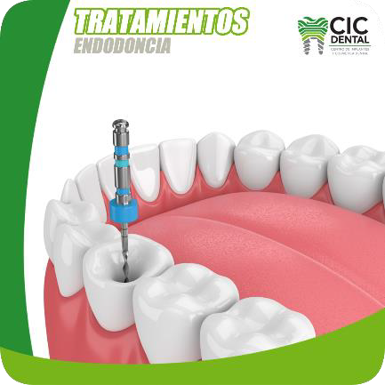 Endodoncia