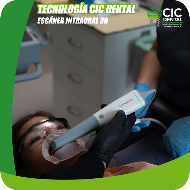 GCD Sitio web Tecnología CD Escáner intraoral 3D